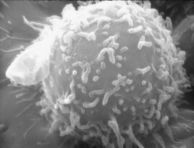 Black and white microscope image of human lymphocyte, which appears as a white ball with tendrils branching off from the surface.