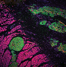 Confocal micrograph of green and pink patches of cells.