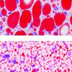 Top panel shows photo of fat tissue with large, bright red droplets; bottom panel shows fat tissue with small, scattered droplets.
