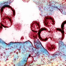 HIV virions budding and releasing from an infected cell.