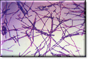 Photomicrograph of anthrax bacteria.  Image courtesy of CDC.