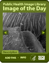 Public Health Image Library Image of the Day Widget. Flash Player 9 is required.