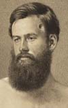 The Medical Case of Civil War Veteran Edson D. Bemis