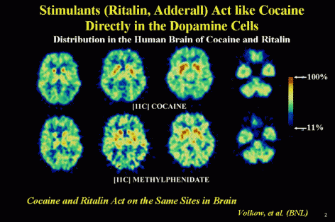PET scan showing that cocaine and methylphenidate act on the same sites in the brain