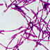 Microscope image showing chains of long, thin bacterial cells.