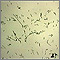 Campylobacter jejuni organism