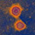 Electron micrograph of Influenza A.