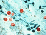 Scientific close-up photo of cryptosporidium oocysts