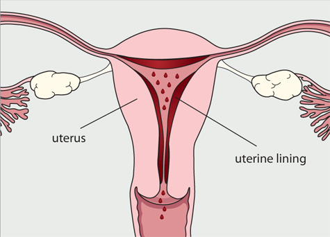 Diagram of the female reproductive system. The blood and tissues lining the uterus (womb) are breaking down and sheding from the body.
