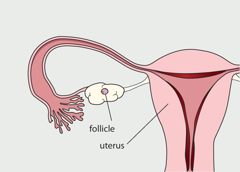 Diagram of the female reproductive system. A follicle has developed and reached maturity. The lining of the uterus has started to thicken.