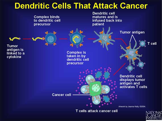 Dendritic Cells That Attack Cancer