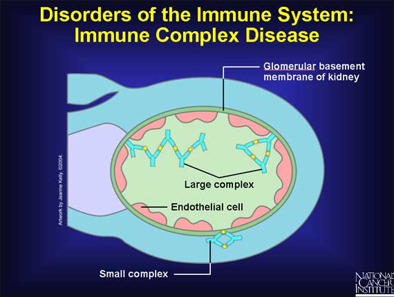 Disorders of the Immune System: Immune Complex Disease