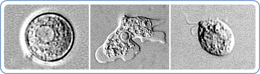 Left: EM image of Naegleria fowleri in its cyst stage. Center: EM image of Naegleria fowleri in its ameboid trophozoite stage. Right: EM image of Naegleria fowleri in its flagellated stage.