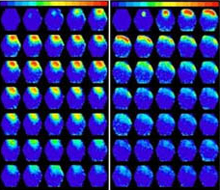 Photo of numerous images of mouse brains, with more on the left showing yellow and red areas.