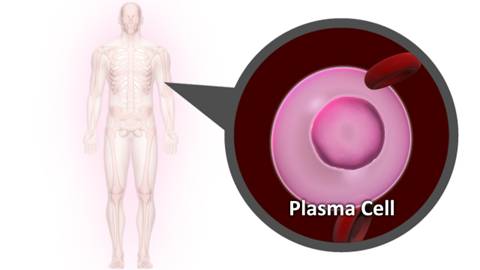 An outline of a human body with a skeleton is shown on the left. An inset circle coming from the body shows a plasma cell and a few red blood cells.