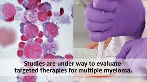 This is a split screen image. A magnified view of stained blood cells is shown on the left and the gloved hands of a researcher doing an experiment are shown on the right. The screen text reads, 'Studies are under way to evaluate targeted therapies for multiple myeloma.'