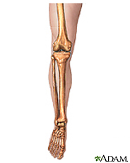 Illustration of a leg showing the leg bones