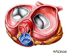 Illustration of the heart valves