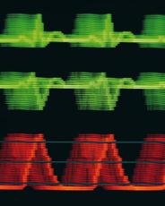 Photograph of EEG and EKG patterns