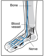Drawing of a foot and ankle showing bones, blood vessels, and nerves inside. A bone, a blood vessel, and a nerve are labeled.