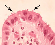 Cryptosporidium seen with a microscope in intestinal cells