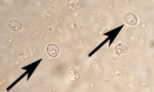 Cryptosporidum passed in stool