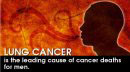 eCard: Lung Cancer