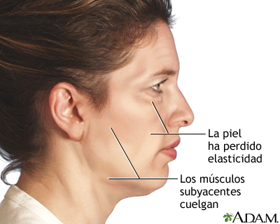 Indicaciones