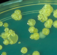 Cultivo de bacterias Cronobacter en un laboratorio
