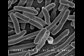 Some bacteria like these E. coli cells move around using whip-like propellers, but other bacteria glide smoothly over a surface using proteins