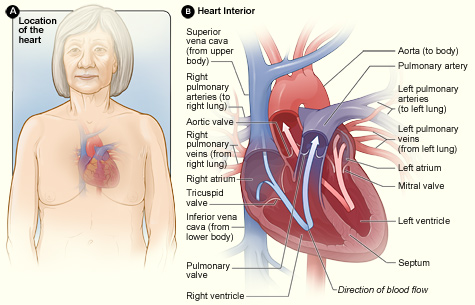 Figure A shows the location of the heart in the body. Figure B shows a cross-section of a healthy heart and its inside structures. The blue arrow shows the direction in which oxygen-poor blood flows through the heart to the lungs. The red arrow shows the direction in which oxygen-rich blood flows from the lungs into the heart and then out to the body.