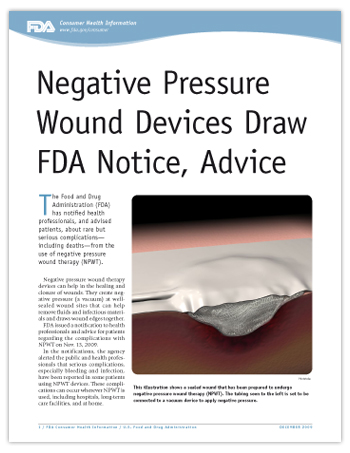 PDF of this article including image of wound therapy (NPWT)