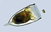 image of a microscopic marine plant