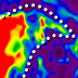 cropped thumbnail image of a liver elastogram