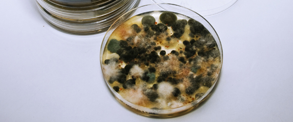 A petri dish with a bacterial culture growing in it.