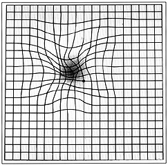 This is what an Amsler grid might look like to someone with AMD.