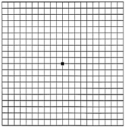 Here is what an Amsler grid normally looks like.