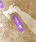 Listeria