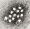 Hepatitis A