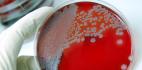 Biological Threats - Gloved hand with culture in a Petri dish.