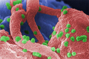 HIV under a microscope