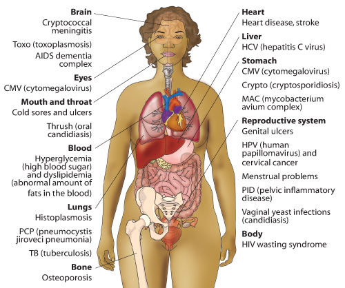 Where opportunistic infections attack the body