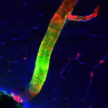 Microscope image of an artery.