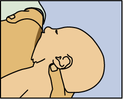 Foto de cómo acercar a los bebés a pecho: Ver el labio inferior y el objetivo que en la medida de la base del pezón como sea posible, por lo que el bebé tiene un gran bocado de pecho.