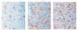 Three photos of liver cells: Click here for full photo caption.