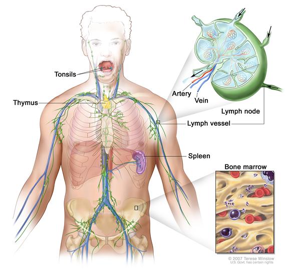 Lymph system; drawing shows the lymph vessels and lymph organs including the lymph nodes, tonsils, thymus, spleen, and bone marrow.  One inset shows the inside structure of a lymph node and the attached lymph vessels with arrows showing how the lymph (clear fluid) moves into and out of the lymph node. Another inset shows a close up of bone marrow with blood cells.