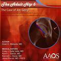 Adult Hip: Case 5 (CD ROM): Arthroscopic Surgery for…