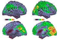 illustration of brain activity