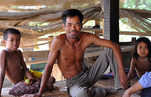 A male patient, Cambodia.