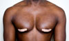 Why do men have nipples?